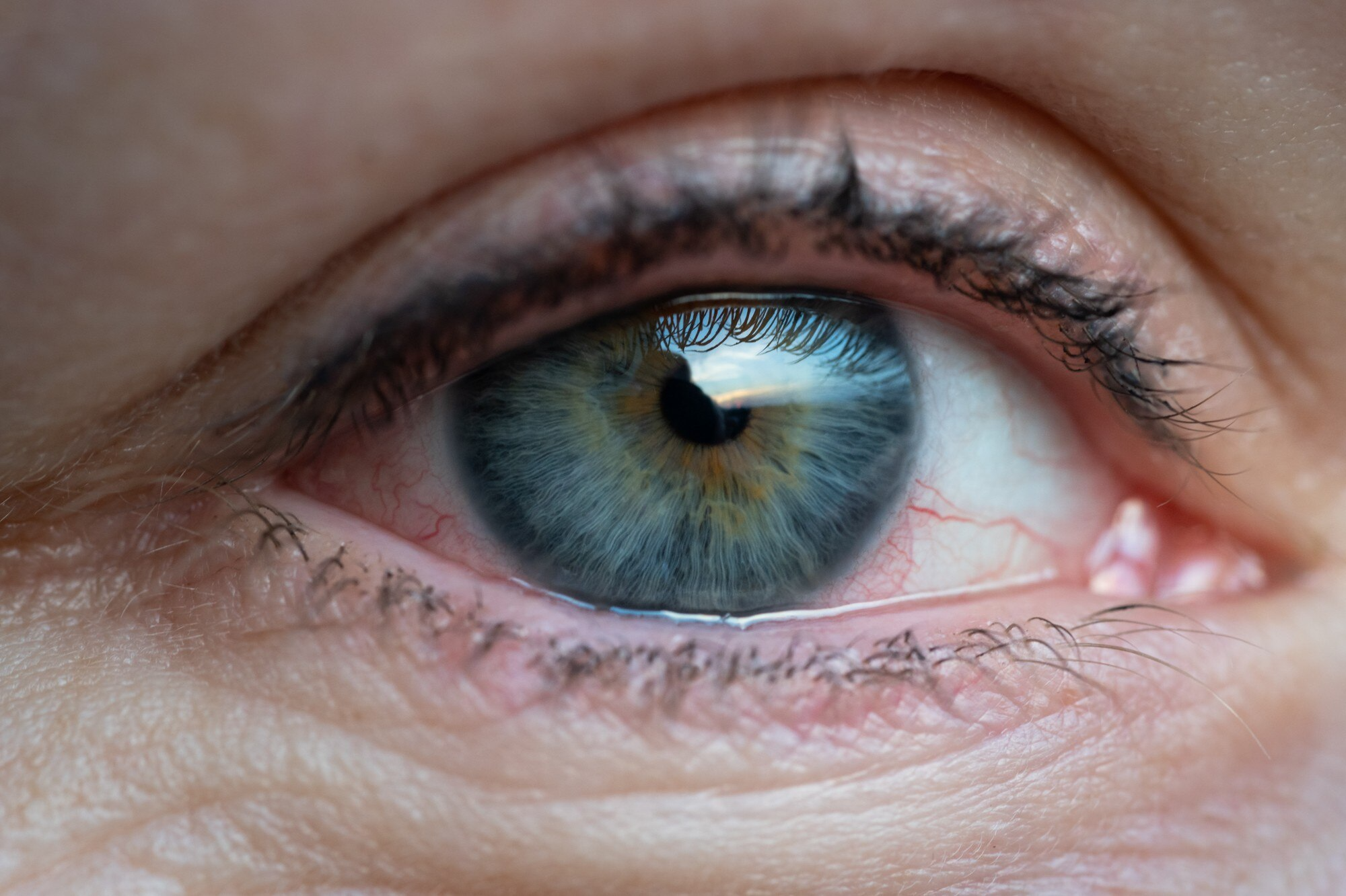 Bimatoprost for Eye Care & Beauty: Treating Glaucoma, Ocular Hypertension & Boosting Lash Growth