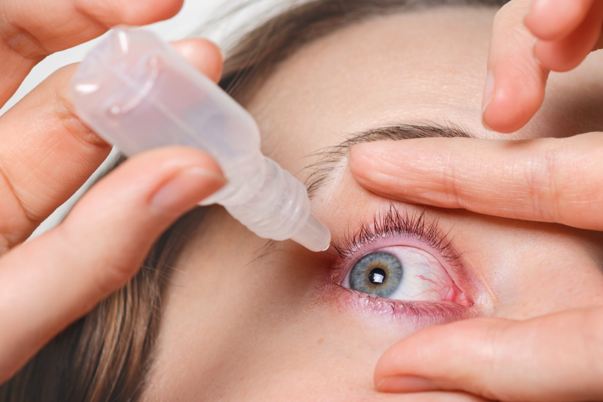 Travoprost API for Glaucoma: Uses, Benefits & Market Demand